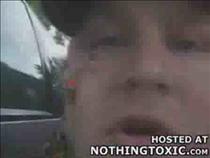 Removing-a-Fish-Hook-From-an-Eyeball